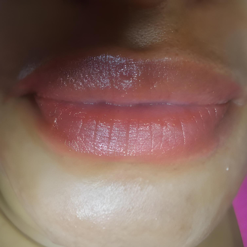 54