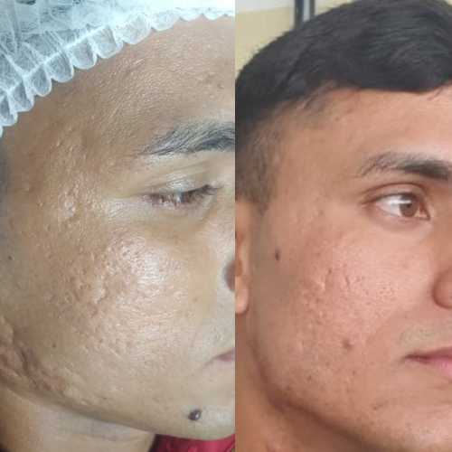 Cópia de Terapia ILIB (8)